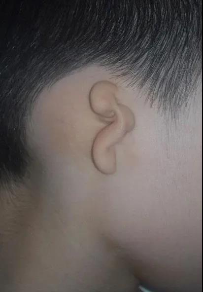 耳朵2.jpg