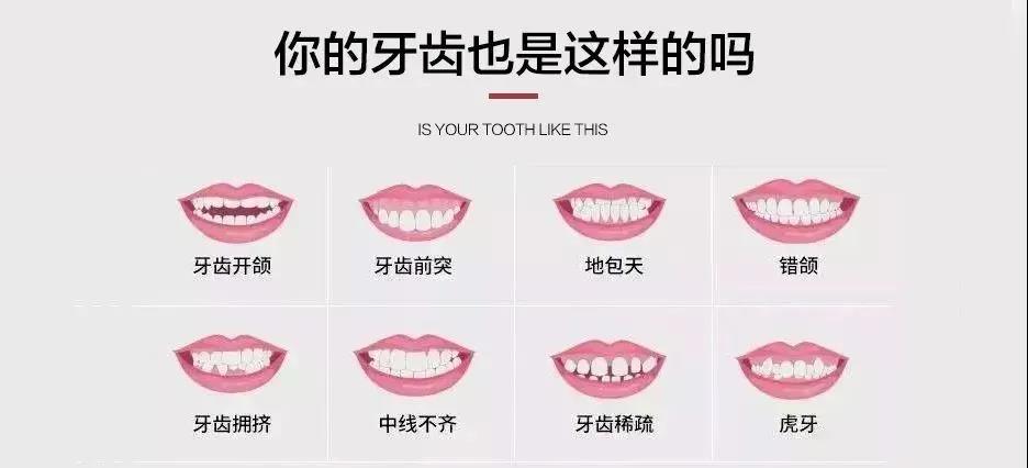 大咖来了！三甲名院正畸专家本周日亲诊坐镇3.jpg