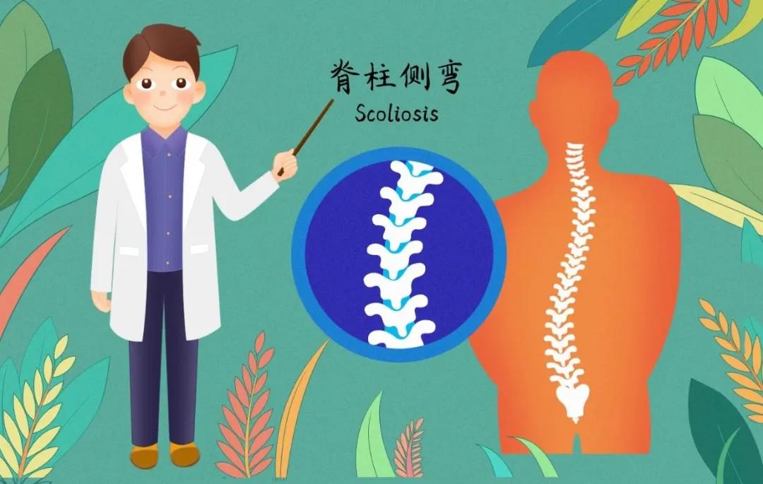 脊柱侧弯4.jpg