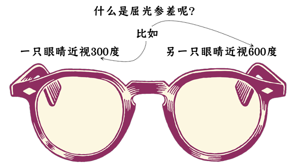 屈光参差4.png